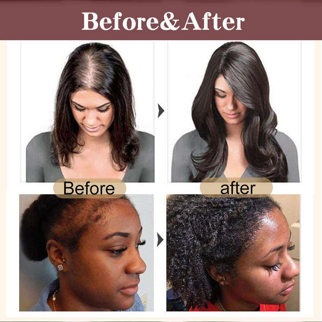 Wholesale Organic Hair Strengthening Growth Oil Cream 100 Percent Unrefined Pure Nourishing Batana Oil for Hair Care