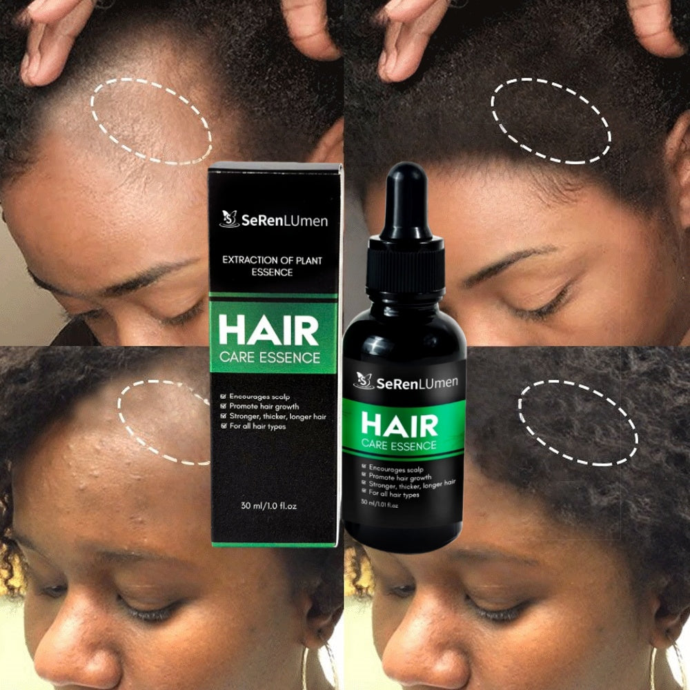 High Quality Home Use 100% Pure Moisturizing Ginger Nourishing Repairing Private Label Fast Hair Growth Oil Serum