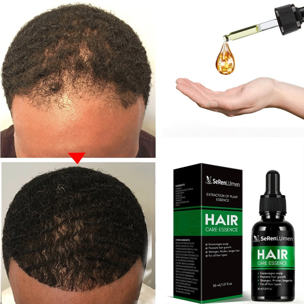 High Quality Home Use 100% Pure Moisturizing Ginger Nourishing Repairing Private Label Fast Hair Growth Oil Serum