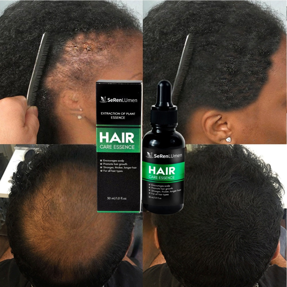 High Quality Home Use 100% Pure Moisturizing Ginger Nourishing Repairing Private Label Fast Hair Growth Oil Serum