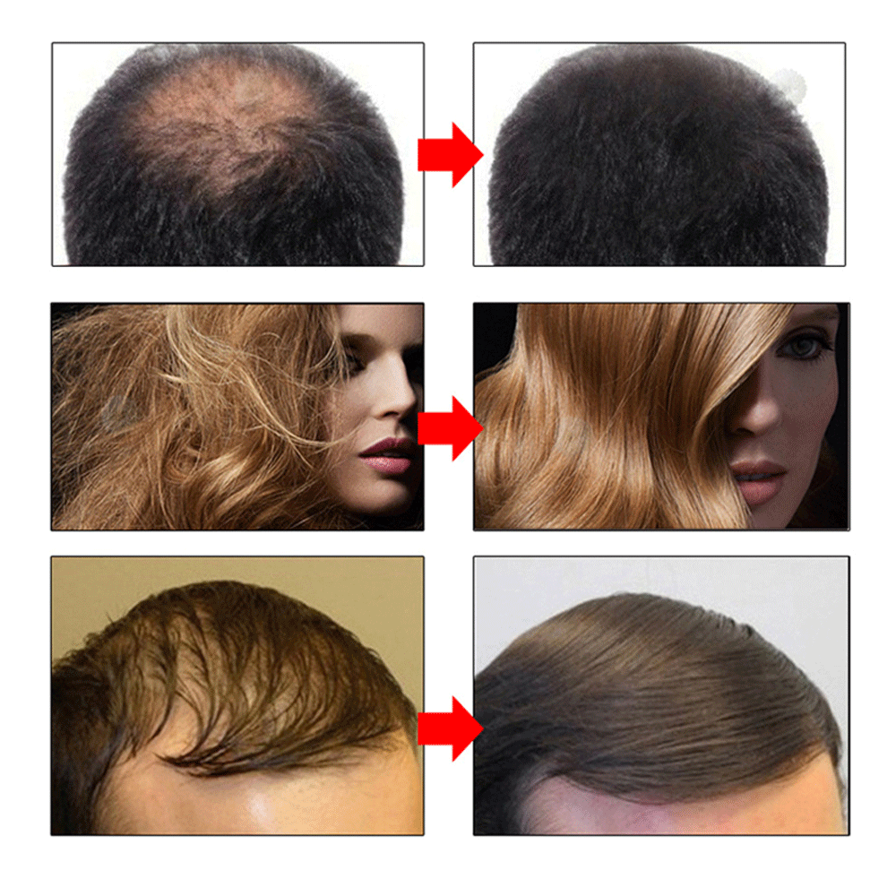 High Quality Home Use 100% Pure Moisturizing Ginger Nourishing Repairing Private Label Fast Hair Growth Oil Serum