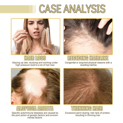 Pure Natural Organic Rosemary Castor Oil Serum Private Label Essential Scalp Hair Care Oil for Hair Growth Nourishing Oil