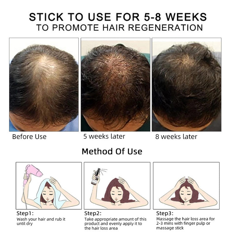 High Quality Home Use 100% Pure Moisturizing Ginger Nourishing Repairing Private Label Fast Hair Growth Oil Serum