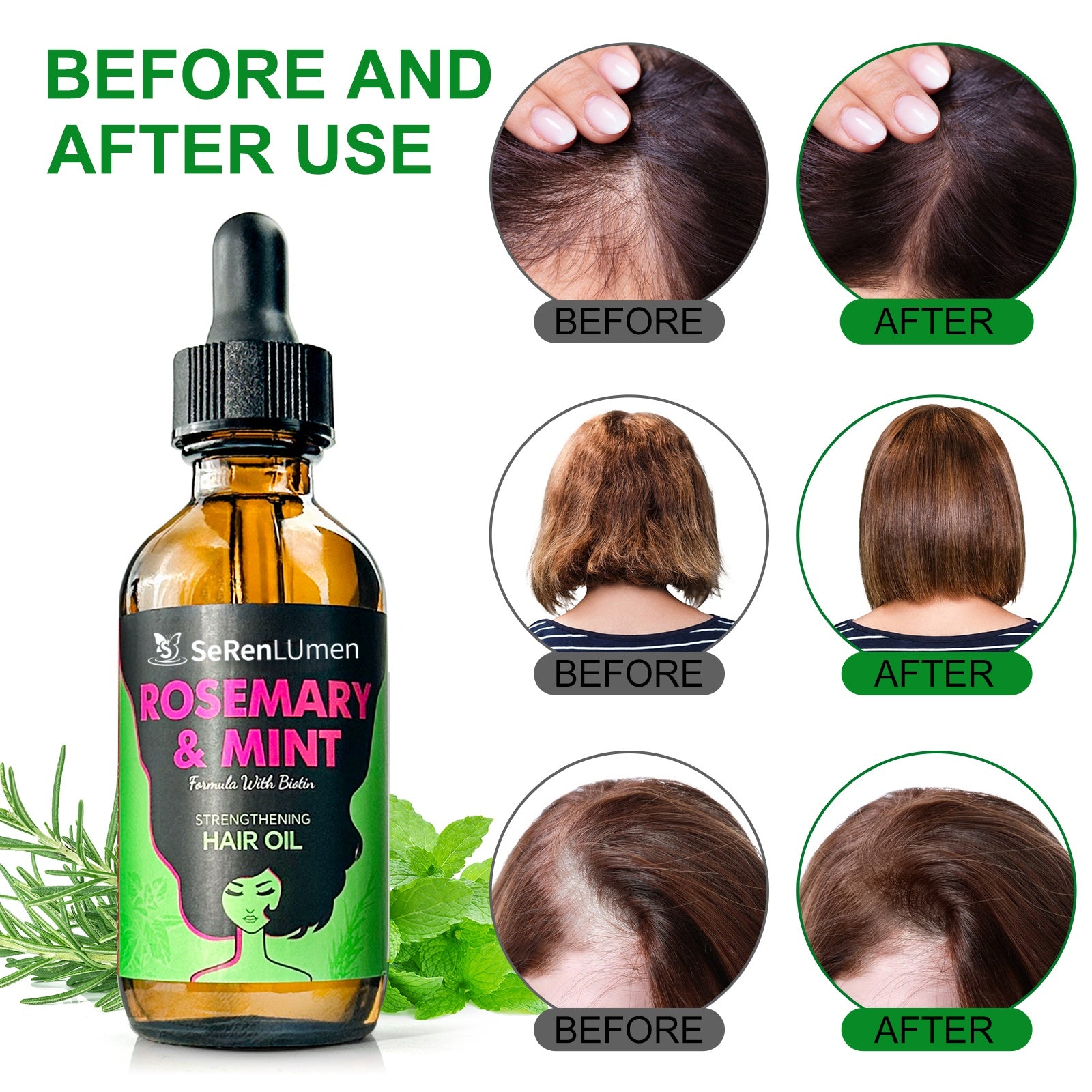 Natural Biotin Organic Anti Dandruff Loss Hair Growth Rosemary Mint Sulfate Free Shampoo and Conditioner Set Private Label